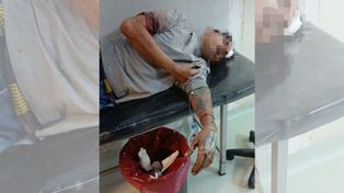 B° El Abasto: vecinos enfurecidos por un robo golpearon a un ladrón que terminó internado en el Cullen