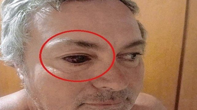 Violento episodio contra un dirigente visitante luego de un partido en Concordia.