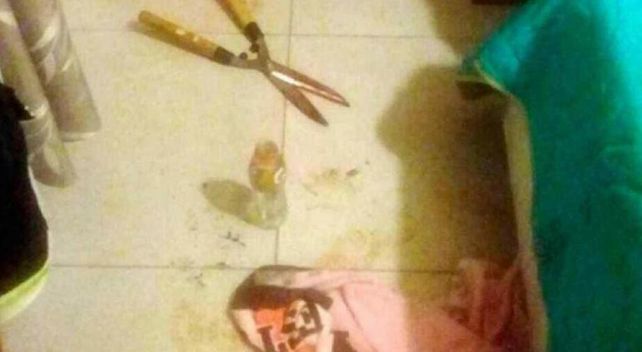 Filosa. La mujer utilizó la podadora para cortar el miembro viril de su pareja. La Voz del Interior