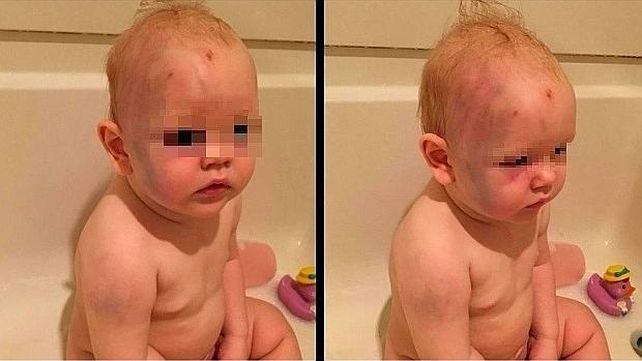 Inconcebible. El bebé muestra huellas de golpes en la cara y en la cabeza.
