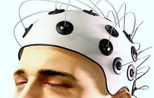 Los resultados de la investigación fueron publicados en la revista The Journal of Neuroscience.