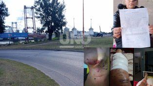 Otro caso de choque y fuga en Santa Fe. Denuncian que un auto en contramano los embistió. Buscan al conductor y piden testigos.