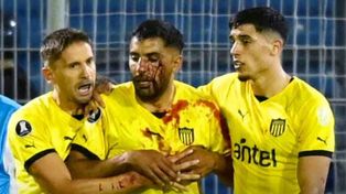 Maxi Olivera fue lastimado con un proyectil y sus compañeros debieron contenerlo tras su reacción.