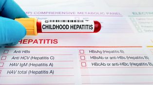 La OMS tiene registrados 429 casos de hepatitis aguda en niños