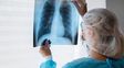 Alerta por tuberculosis en Argentina: los casos aumentaron 80% en cinco años