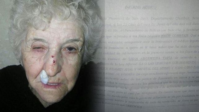 La mujer tiene 80, fue asaltada y en la comisaría le pidieron un insólito examen