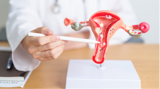 La OMS estima que el HPV es responsable del 4,5% de todos los cánceres a nivel global