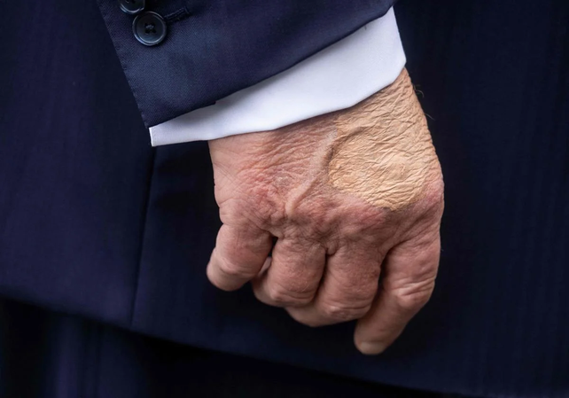 ¿Qué está pasando con las manos de Donald Trump?: las imágenes que se hicieron virales