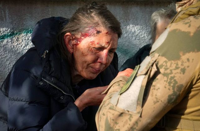 Herida y conmocionada, una vecina de Kiev recibe primeros auxilios en la calle. 