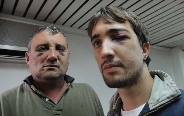 Nahuel y su padre quedaron maltrechos tras la feroz paliza.