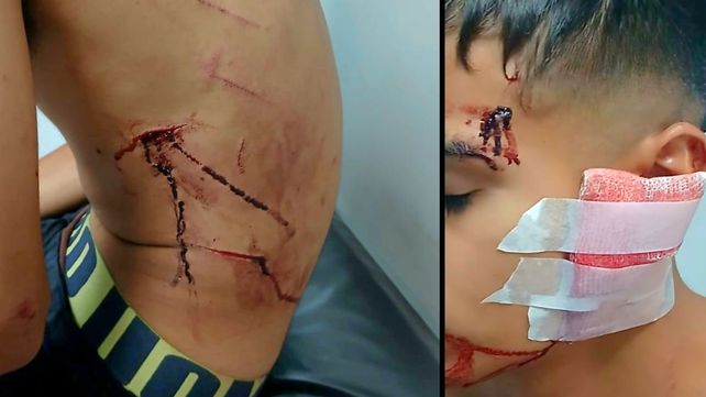 B° Barranquitas: tres heridos en una batalla campal entre decenas de personas armadas