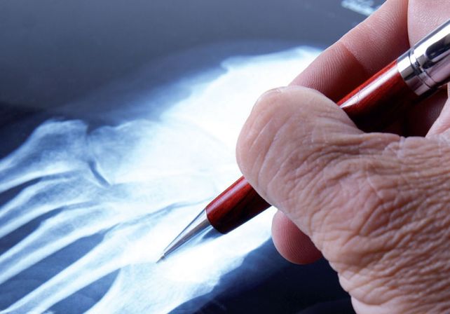 Para Atos, no hubo avances y el conflicto continúa