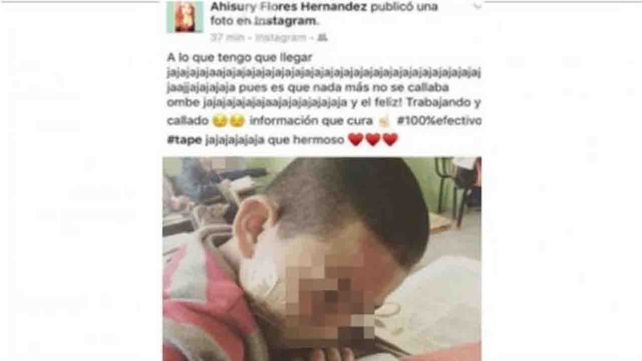 Una maestra le encintó la boca a alumno porque no paraba de hablar
