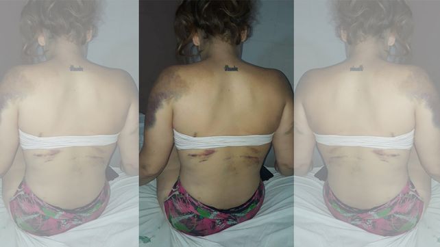 La mujer fue atendida en un sanatorio debido a la gran cantidad de golpes recibidos.&nbsp; 