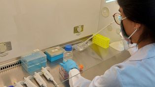 Cómo se encuentra el primer caso sospechoso de viruela del mono en Argentina