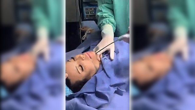 La mediática Charlotte Caniggia compartió un video realizándose un retoque en la cara. Las imágenes no son aptas para personas sensibles