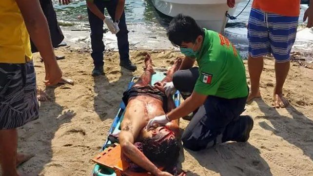 Atacan a machetazos a tres jóvenes argentinos en la costa mexicana de Oaxaca. Uno está grave por una herida en la cabeza. Qué dijeron las autoridades en México