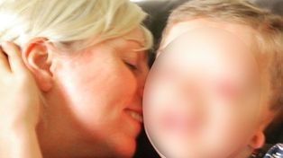 Instagram censuró por inapropiada la foto de un nene con malformación