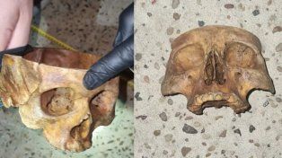 Una vecina encontró un cráneo en una calle de General Ramírez.