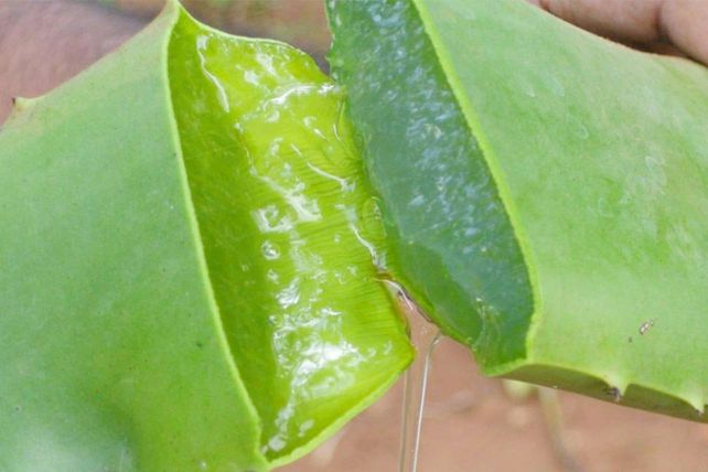 Elimina la caspa que te agobia, de manera natural