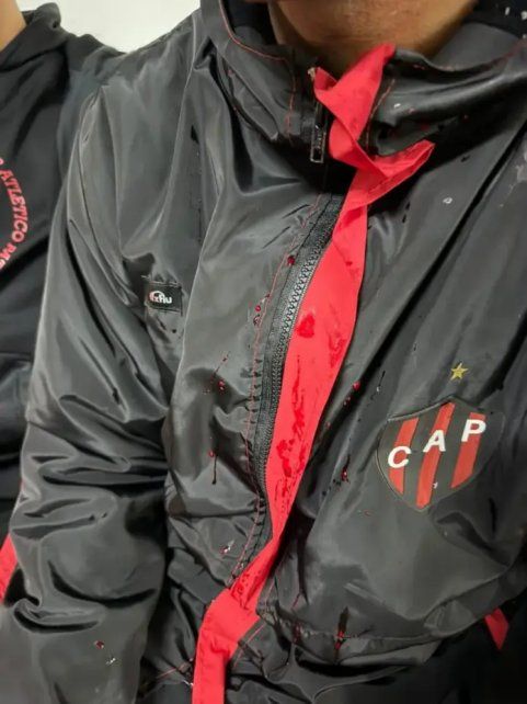 Patronato: un jugador reveló que recibió un culatazo en la cabeza durante el ataque de la barra
