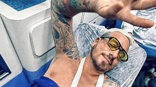 Federico Bal contó desde Brasil los detalles del accidente que sufrió