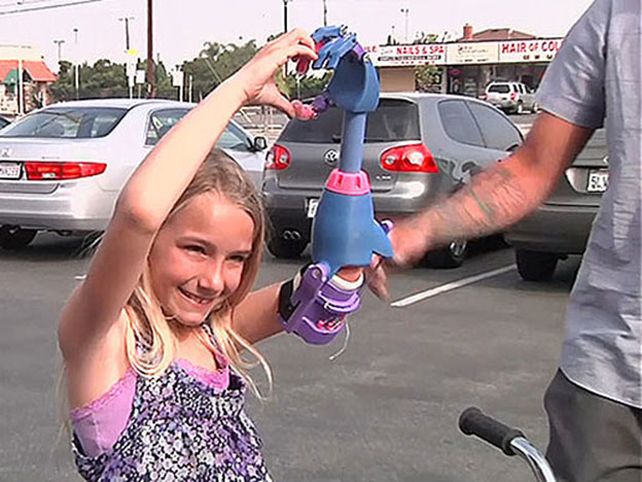 Impresión en 3D permite a niña tener prótesis de mano