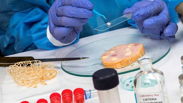Tras un brote de listeriosis desde la Facultad de Bromatología brindan datos para prevenir esta enfermedad transmitida a través de alimentos