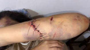 Santa Ana: una mujer fua atacada con un hacha