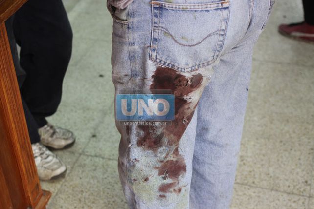 Foto: UNO/Juan Ignacio Pereira