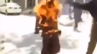 Un hombre casi muere calcinado luego de que le explotara la batería de su celular en la mano