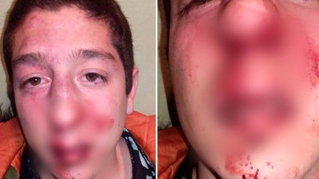 Insólito: patovicas le pegaron por error y le dieron entradas gratis como disculpas