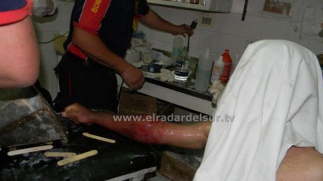 Un preso debió ser asistido por los bomberos al quedar atorado en un mingitorio