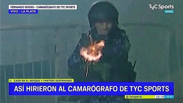 Camarógrafo sufrió tres balazos de goma durante los graves incidentes en el partido Gimnasia - Boca