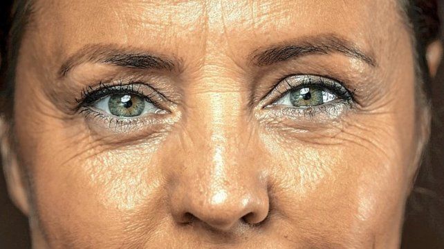 Una forma poco costosa para prevenir y combatir las arrugas