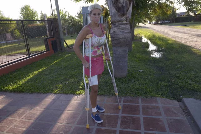 Mariana Ortigala luego de haber sufrido un atentado en un chalet de Roldán en 2020