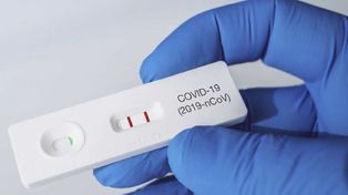 El Gobierno definió el modo en que se deberá informar el resultado de los autotest de Covid-19.