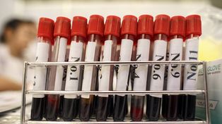 Las personas diagnosticadas con VIH/Sida reciben cobertura integral del Estado