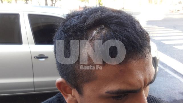 Denunció una salvaje agresión por parte de la Policía en la cancha de Unión