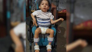 Iniciaron una colecta para un santafesino de 4 años con parálisis cerebral: debe viajar a la India para tratarse