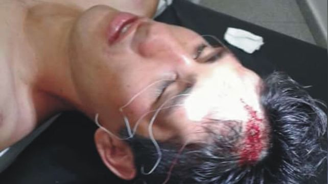 Policías molieron a golpes a un joven en un boliche de Las Toscas