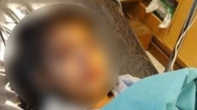 La nena de 7 años fue dada de alta luego de haber sufrido un coma alcohólico.