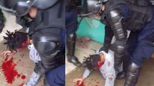 Sin justificación. El Grupo Especial de la Policía baleó en el rostro antes de reducir a un adolescente en crisis, de no más de 50 kilos.&nbsp;