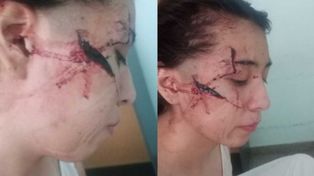 El impactante testimonio de la madre de la joven de 15 años atacada por una patota en San Cristóbal