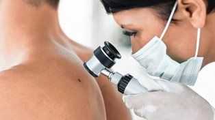 Inicia la Campaña de Prevención del Cáncer de Piel