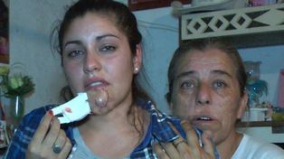 Se cruzó con su ex en un boliche y la desfiguró a mordiscones