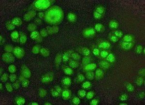 Cáncer de mama: estrategia para mejorar la terapia estándar