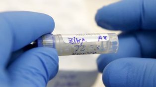 Vacuna. El zika desató una ola de preocupación al descubrirse su vinculación con la microcefalia, letal en los bebés.