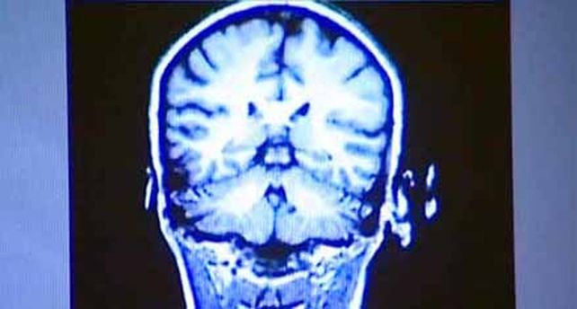La p&eacute;rdida de la capacidad cognitiva comienza a los 45 a&ntilde;os