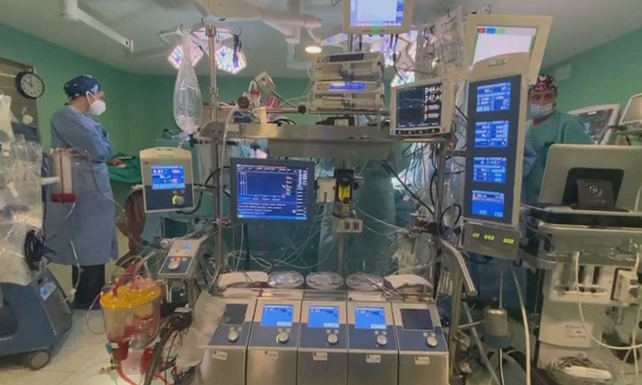 Una máquina de circulación extracorpórea